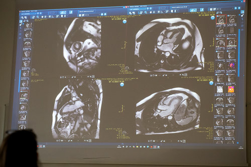10th School of Cardiac Diagnostics, day 1 / Photo: Saša Huzjak / SHtudio.eu